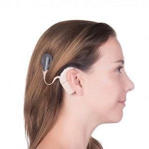 Cochlear announces $800 million capital raise to ride out market uncertainty Cochlear announces $800 million capital raise to ride out market uncertainty